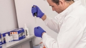 Анализ на тиреотропный гормон (ТТГ)