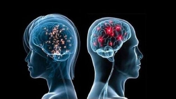 Причина шизофрении – воспаление в мозге